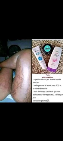 Produits contre les vergetures